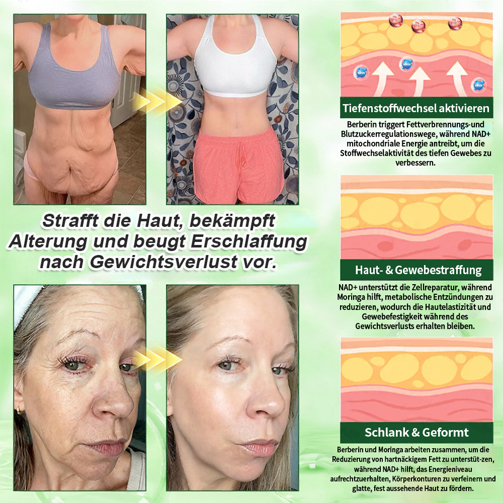 🔥 Offizieller Bestseller丨Purelora® Moringa Berberine NAD+ 10-in-1 Nano-Mikronadel-Patch (Nur einmal täglich, sichtbare Veränderungen in 7 Tagen) ✅ Für Übergewicht, lockere Haut, Diabetes, Schlafapnoe, Gelenkprobleme und mehr