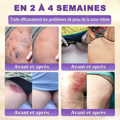 Fabriquée et expédiée depuis la France 🍁 Crème réparatrice pour la peau à la biotine Purelora® (formule 10-en-1) — Dernier jour de la promotion : -25 %.