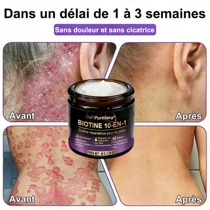 Fabriquée et expédiée depuis la France 🍁 Crème réparatrice pour la peau à la biotine Purelora® (formule 10-en-1) — Dernier jour de la promotion : -25 %.