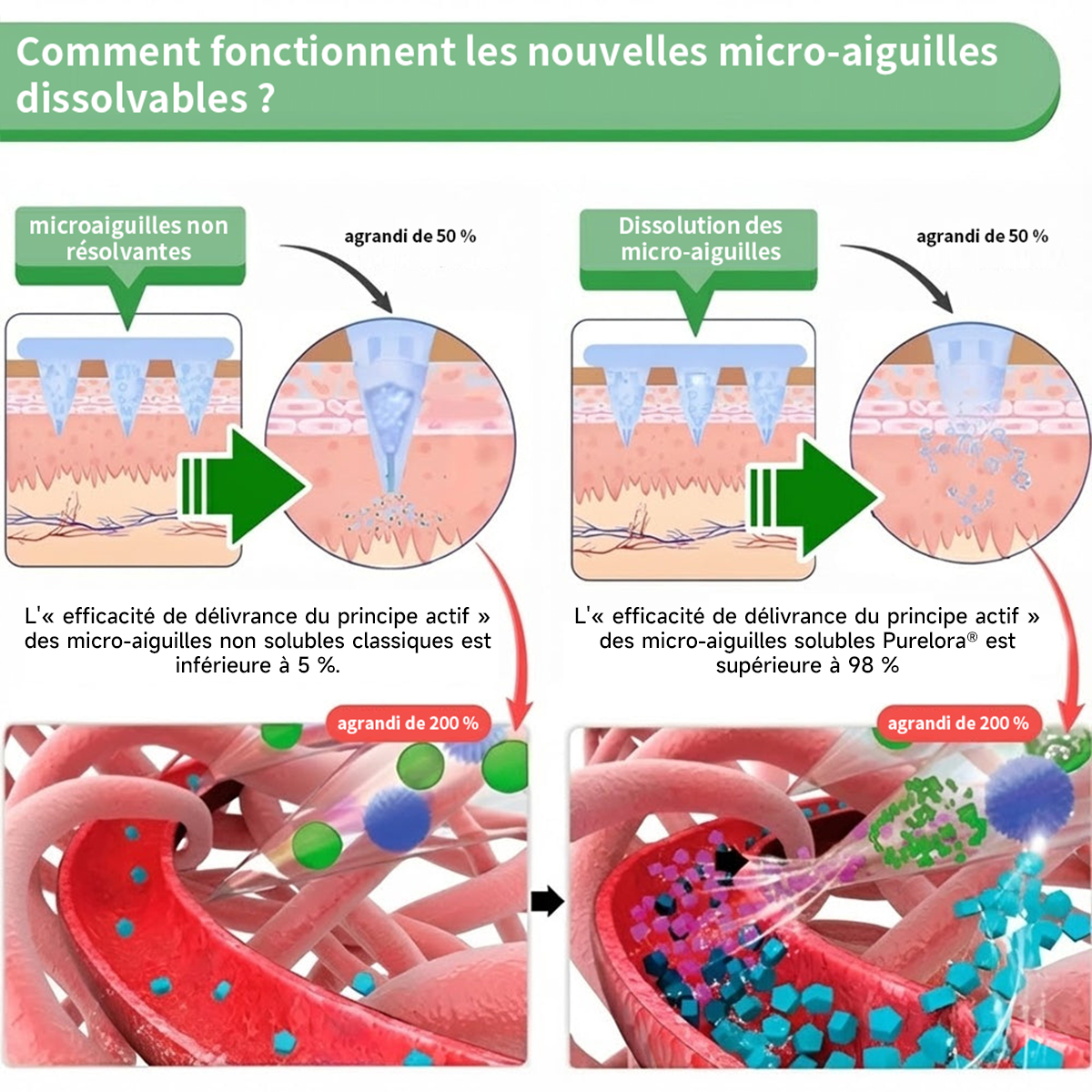 🔥 Nouveauté | Patch Purelora® 10-en-1 aux nanomicroneedles : Berbérine, Vinaigre de cidre et EGCG — Brûle les graisses tenaces • Réduit les rides • Favorise le confort articulaire (Résultats visibles en seulement 7 jours)