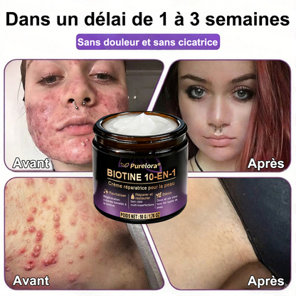 Fabriquée et expédiée depuis la France 🍁 Crème réparatrice pour la peau à la biotine Purelora® (formule 10-en-1) — Dernier jour de la promotion : -25 %.