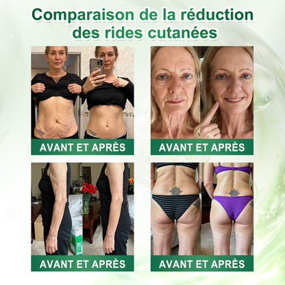 🔥 Nouveauté ! | Curalona® Détox Lymphatique : Essence Sculptante 10-en-1. Éliminez les toxines, brûlez les graisses tenaces et favorisez la santé articulaire. (Ressentez votre corps s'alléger après seulement 7 jours d'utilisation continue !)