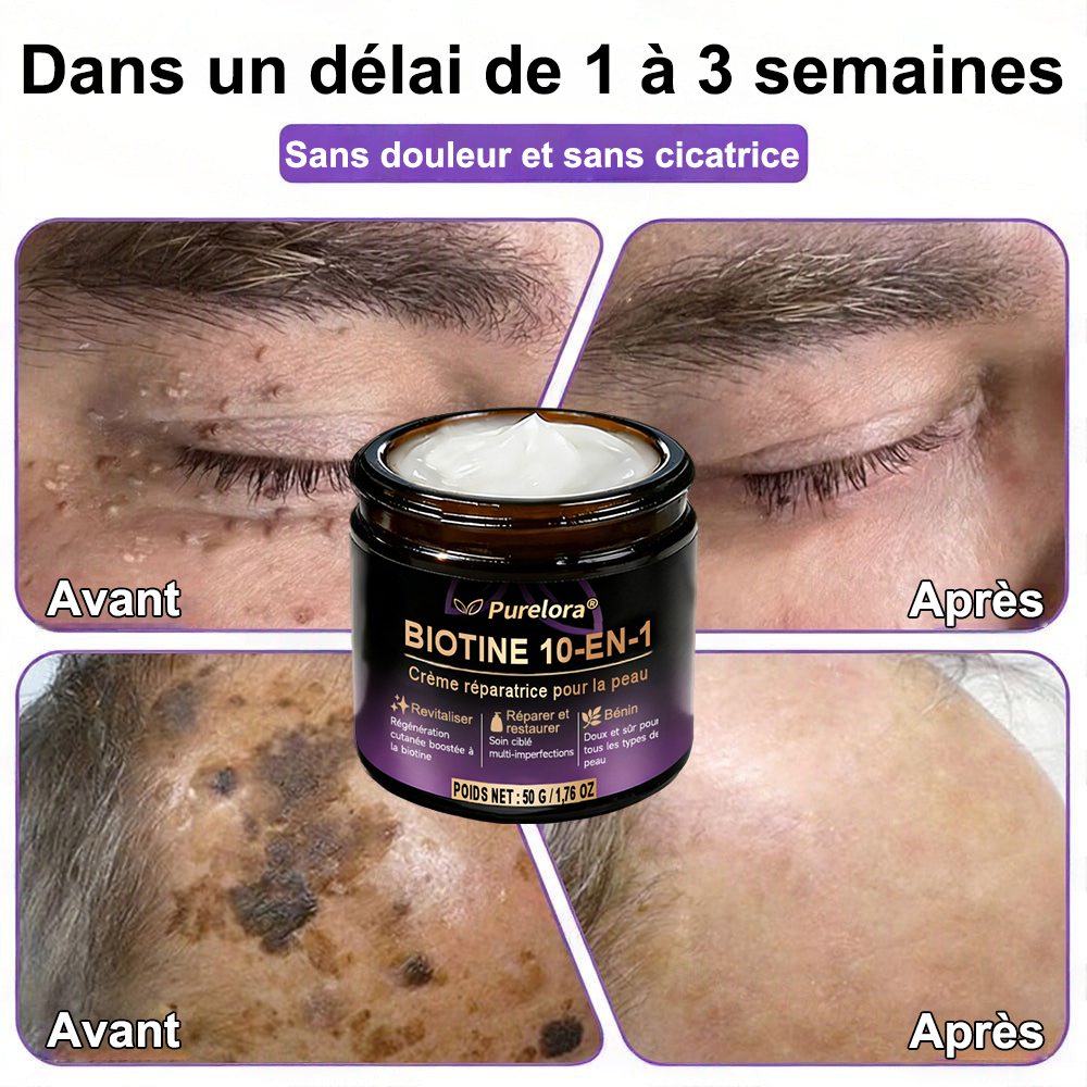 Fabriquée et expédiée depuis la France 🍁 Crème réparatrice pour la peau à la biotine Purelora® (formule 10-en-1) — Dernier jour de la promotion : -25 %.
