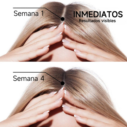 🌿👨‍⚕️ Boutique officielle française | 🔥 Shampoing et après-shampoing 2-en-1 PURELORA® à l'oignon et au romarin — Enrichi d'un complexe actif stimulant la croissance capillaire (concentration x15) pour des cheveux plus épais, plus denses et plus forts.