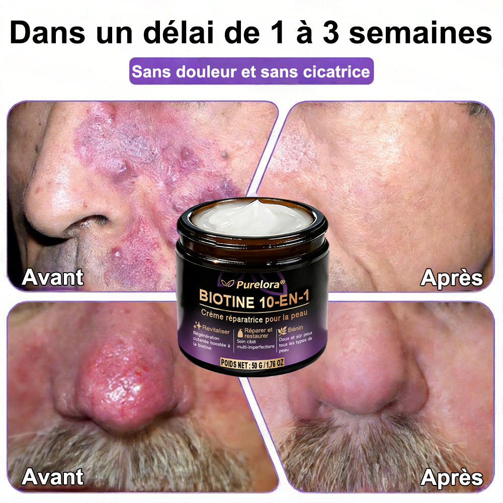 Fabriquée et expédiée depuis la France 🍁 Crème réparatrice pour la peau à la biotine Purelora® (formule 10-en-1) — Dernier jour de la promotion : -25 %.
