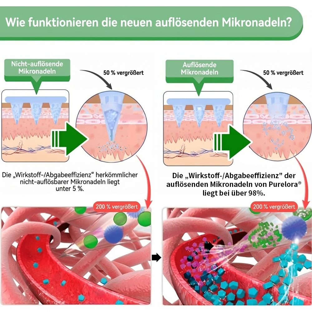 💖𝑶𝒏𝒍𝒊𝒏𝒆-𝑨𝒑𝒐𝒕𝒉𝒆𝒌𝒆💖丨Purelora® Moringa Berberine x NAD+ 20-in-1 Nano-Mikronadel-Patch (Nur einmal täglich, sichtbare Veränderungen in 7 Tagen) ✅ Für Übergewicht, lockere Haut, Diabetes, Schlafapnoe, Gelenkprobleme und mehr