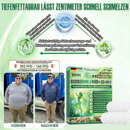 💖𝑶𝒏𝒍𝒊𝒏𝒆-𝑨𝒑𝒐𝒕𝒉𝒆𝒌𝒆💖丨Purelora® Moringa Berberine x NAD+ 20-in-1 Nano-Mikronadel-Patch (Nur einmal täglich, sichtbare Veränderungen in 7 Tagen) ✅ Für Übergewicht, lockere Haut, Diabetes, Schlafapnoe, Gelenkprobleme und mehr