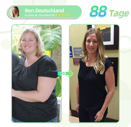 🔥𝑶𝒇𝒇𝒊𝒄𝒊𝒂𝒍 𝑺𝒕𝒐𝒓𝒆🍇  | Purelora® Moringa × Berberin 10-in-1 Fortschrittliches Nano-Mikronadelpflaster (Einmal täglich, sichtbare Veränderungen innerhalb von 7 Tagen)