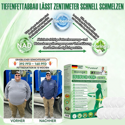🔥 Offizieller Bestseller丨Purelora® Moringa Berberine NAD+ 10-in-1 Nano-Mikronadel-Patch (Nur einmal täglich, sichtbare Veränderungen in 7 Tagen) ✅ Für Übergewicht, lockere Haut, Diabetes, Schlafapnoe, Gelenkprobleme und mehr