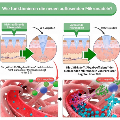 🔥 Offizieller Bestseller丨Purelora® Moringa Berberine NAD+ 10-in-1 Nano-Mikronadel-Patch (Nur einmal täglich, sichtbare Veränderungen in 7 Tagen) ✅ Für Übergewicht, lockere Haut, Diabetes, Schlafapnoe, Gelenkprobleme und mehr