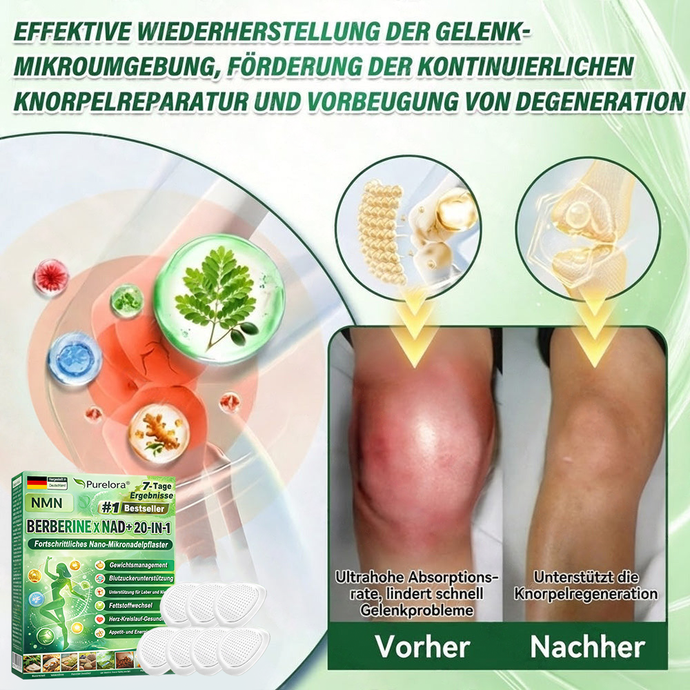 💖𝑶𝒏𝒍𝒊𝒏𝒆-𝑨𝒑𝒐𝒕𝒉𝒆𝒌𝒆💖丨Purelora® Moringa Berberine x NAD+ 20-in-1 Nano-Mikronadel-Patch (Nur einmal täglich, sichtbare Veränderungen in 7 Tagen) ✅ Für Übergewicht, lockere Haut, Diabetes, Schlafapnoe, Gelenkprobleme und mehr