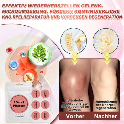 💖𝑶𝒏𝒍𝒊𝒏𝒆-𝑨𝒑𝒐𝒕𝒉𝒆𝒌𝒆丨Purelora® Moringa Berberine NAD+ 10-in-1 Nano-Mikronadel-Patch (Nur einmal täglich, sichtbare Veränderungen in 7 Tagen) ✅ Für Übergewicht, lockere Haut, Diabetes, Schlafapnoe, Gelenkprobleme und mehr