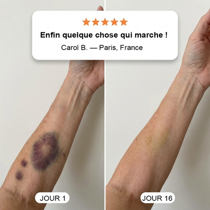 💥Plus de 100 000 unités vendues💕 - Crème PURELORA® pour réparer les bleus et renforcer la peau