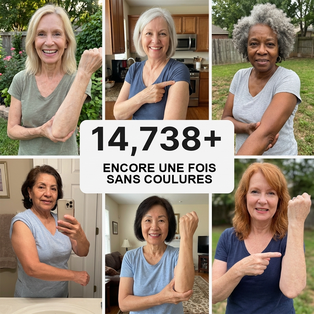 💥Plus de 100 000 unités vendues💕 - Crème PURELORA® pour réparer les bleus et renforcer la peau